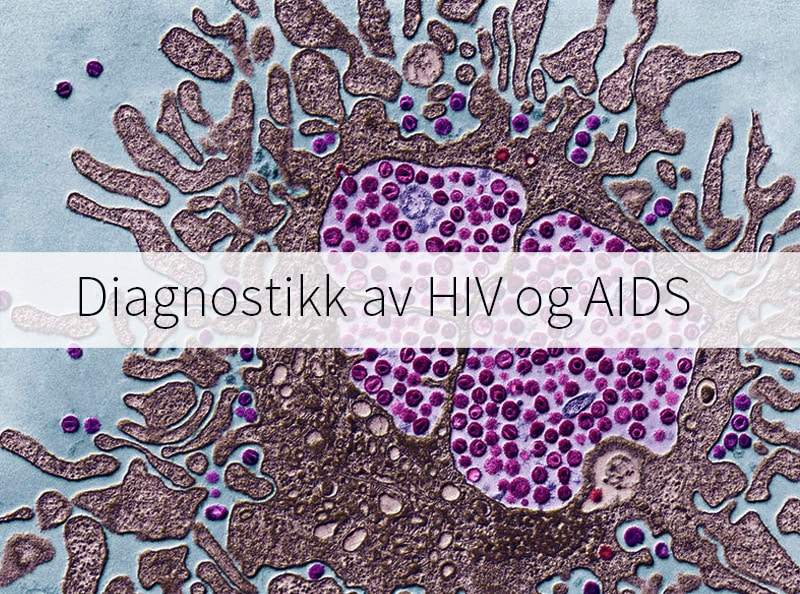 HIV:n testaus ja diagnostiikka
