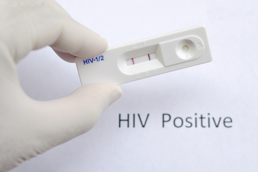HIV-testien merkitys: HIV-testaus: Terveytesi hallitseminen
