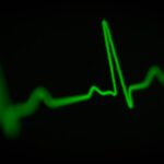 Hjerteinfarkt: En Omfattende Guide til Forståelse og Forebygging